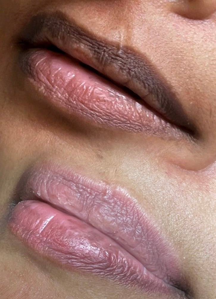 Dark Lip Neutralisation - Permanent Makeup Treatment